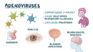 ADENOVIRUS INFECTION